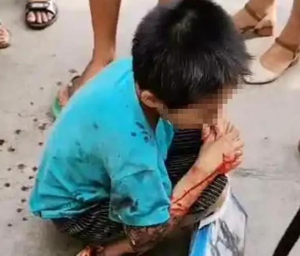 2025新澳正版资料今晚和7岁男孩遭3只犬撕咬与7岁男孩遭3只犬撕咬怎么办